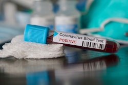 03.20.COVID-19 coronavirus test vial-min