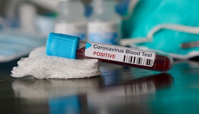 COVID-19 coronavirus blood test vial