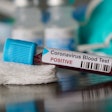 Blood test vial for COVID-19