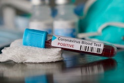 Blood test vial for COVID-19
