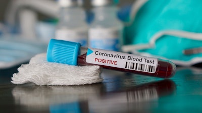 Blood test vial for COVID-19